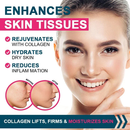 Multiple Collagen Complex - Types I, II, III, V, and X - Hair, Skin, Nail, Bones, Joint Health Support - AMULET RING STORE