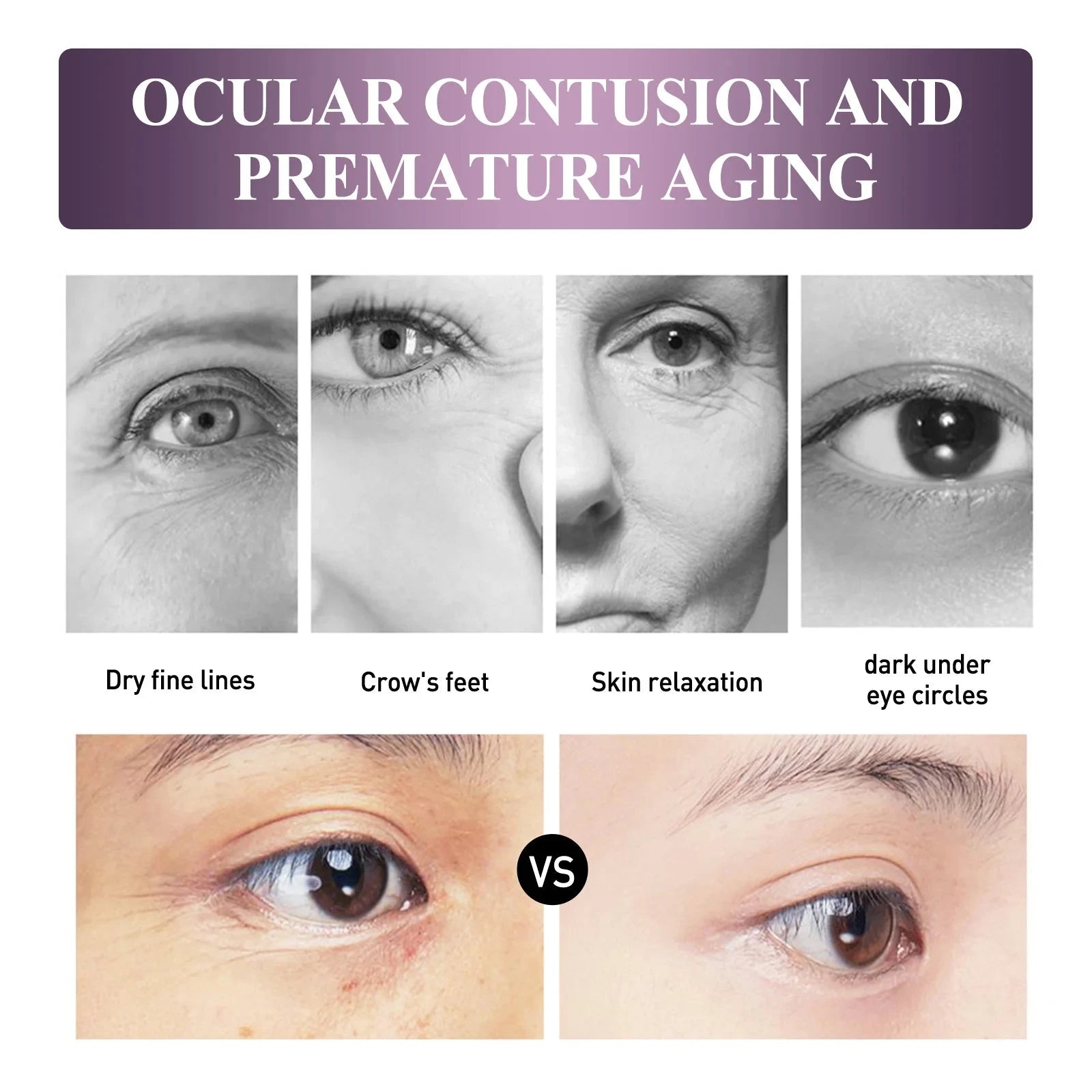 Electric Massage Eye Cream Anti Wrinkle Eye Patches Moisturizing Improve Bags Nourish Area Against Puffiness Bags Hydrate - AMULET RING STORE