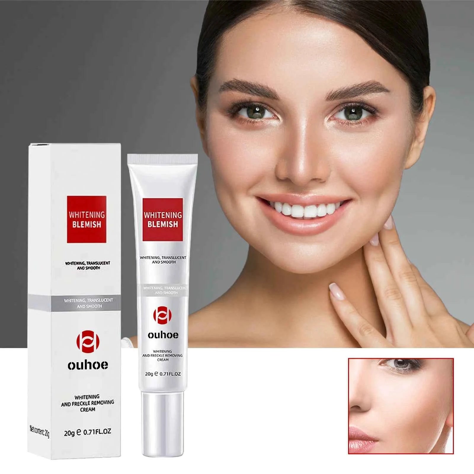 Ouhoe 20g Niacinamide Dark Spots Remover Cream Lighten Melanin Improve Dullness Brighten Skin Tone Smooth Face Repairing Cream