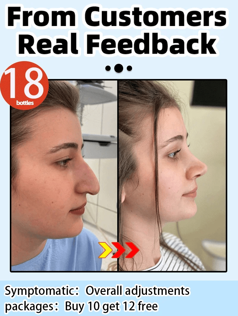 Nose Massage Essential Oil Up Heighten Rhinoplasty Firming For Moisturizing Nose Serum Reshape Natural Face Beauty Care Products - AMULET RING STORE