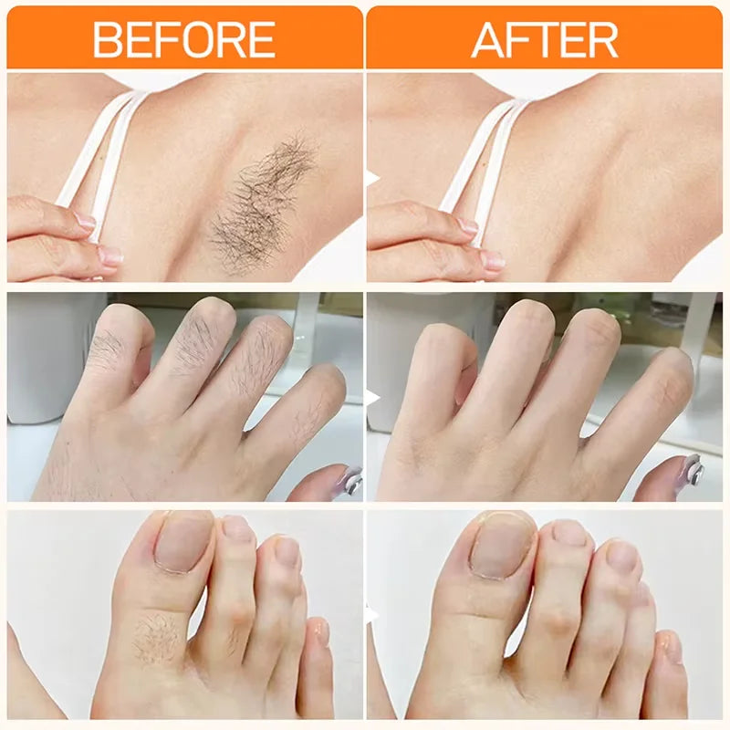 3 Minutes Fast Hair Removal Cream Painless Hair Growth Inhibitor Lip Face Arm Armpit Leg Permanent Depilatory for Men Women Care - AMULET RING STORE