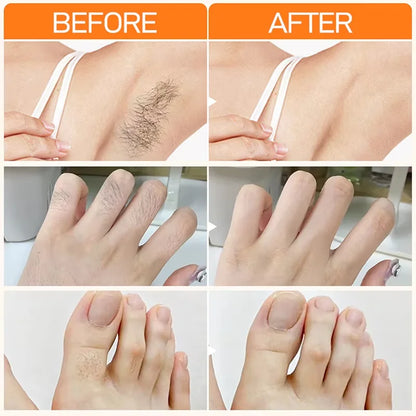 3 Minutes Fast Hair Removal Cream Painless Hair Growth Inhibitor Lip Face Arm Armpit Leg Permanent Depilatory for Men Women Care - AMULET RING STORE