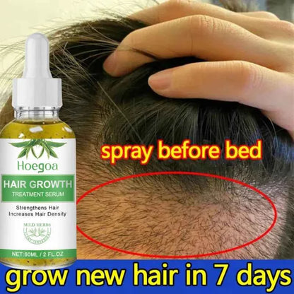 Fast Hair Growth Oil Africa Crazy Traction Alopecia Serum Anti Hair Break Thicken Hair Loss Treatment Spray For Man Women 60ML