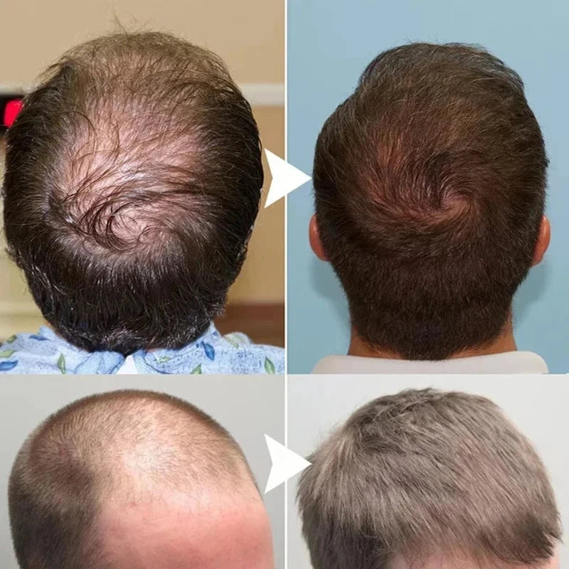 Ginger Hair Growth Serum 7 Days Fast Regrowth Essential Oil Anti Hair loss Prevent Hair Dry Frizzy Damaged Repair Care Products