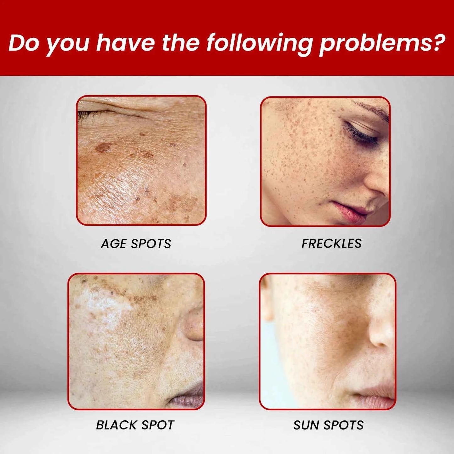 Ouhoe 20g Niacinamide Dark Spots Remover Cream Lighten Melanin Improve Dullness Brighten Skin Tone Smooth Face Repairing Cream