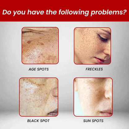 Ouhoe 20g Niacinamide Dark Spots Remover Cream Lighten Melanin Improve Dullness Brighten Skin Tone Smooth Face Repairing Cream