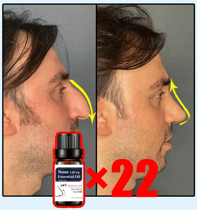 Nose Massage Essential Oil Up Heighten Rhinoplasty Firming For Moisturizing Nose Serum Reshape Natural Face Beauty Care Products - AMULET RING STORE