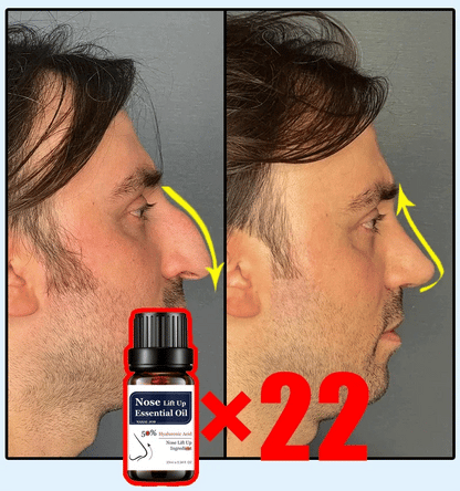 Nose Massage Essential Oil Up Heighten Rhinoplasty Firming For Moisturizing Nose Serum Reshape Natural Face Beauty Care Products - AMULET RING STORE