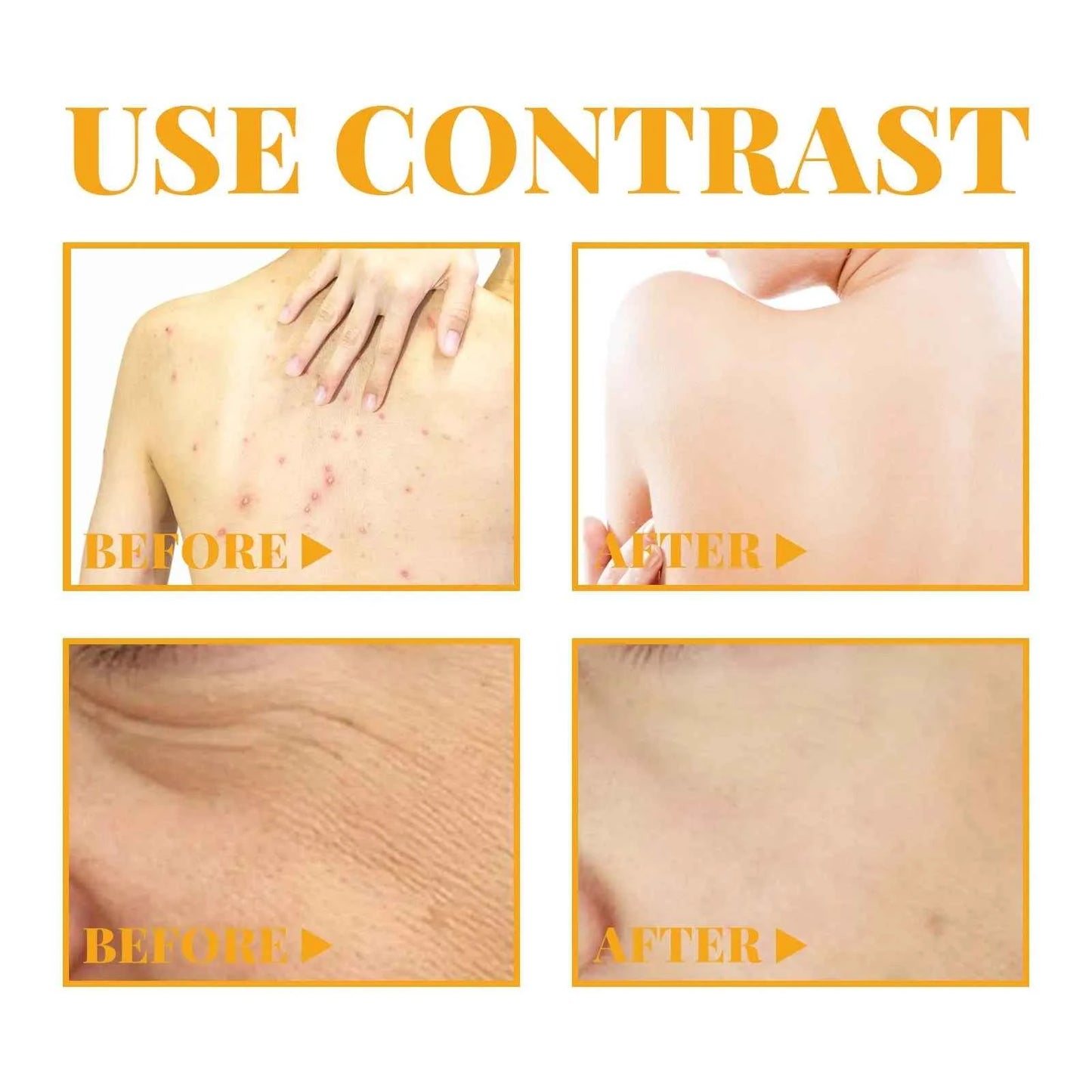 AHA Body Serum Collagen Moisturizing Spots Eraser Corrector Shrink Pore Repair Lighten Body Face Skin Care Hydrating Face Serum