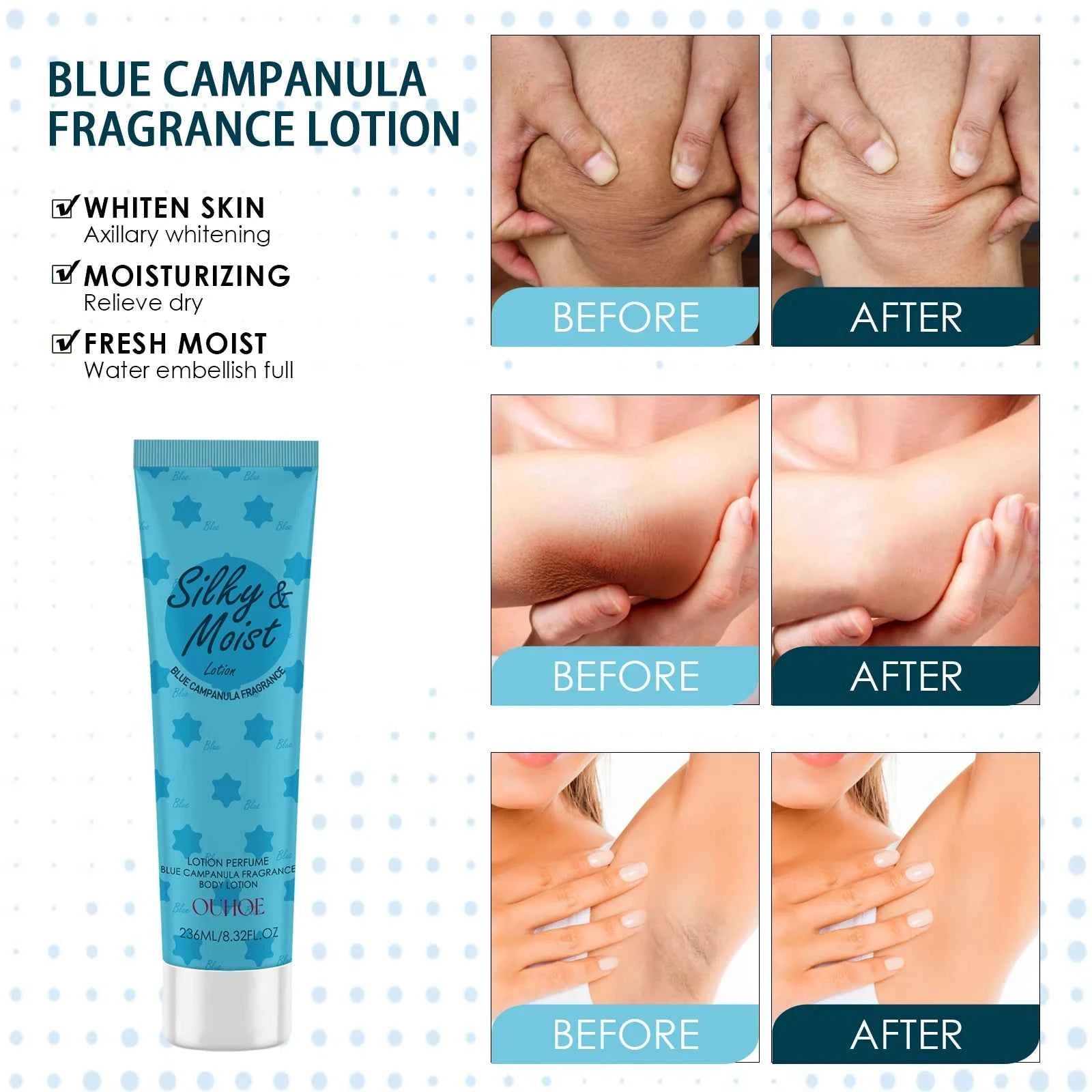 OUHOE Silky&Moist Lotion Body Lightening Armpit Knee Joint Dark Moisturizing Skin Whitening Body Beauty Care