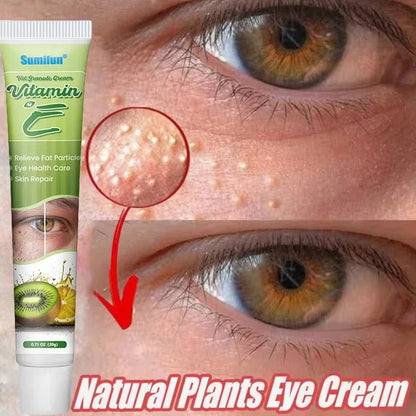 Fat Granules Remover Eye Cream Effective Remove Fat Granules Puffiness Anti-Particles Milia Remover Product Repair Eye Skin Care - AMULET RING STORE