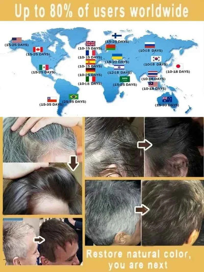 White hair killer, remove gray hair and restore natural hair color in 7 days 2025