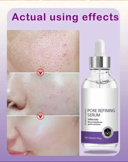 Skin Texture | Pore Refining Resurfacing, Brightening Facial Serum with Retinol and Niacinamide Non-Comedogenic - AMULET RING STORE