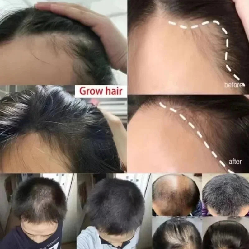 Ginger Hair Growth Serum 7 Days Fast Regrowth Essential Oil Anti Hair loss Prevent Hair Dry Frizzy Damaged Repair Care Products