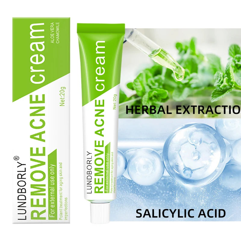 LUNDBORLY Acne Care Cream with Natural Herbal Extracts Helps Soothe Skin Improve Skin Texture and Keep Skin Smooth and Radiant - AMULET RING STORE