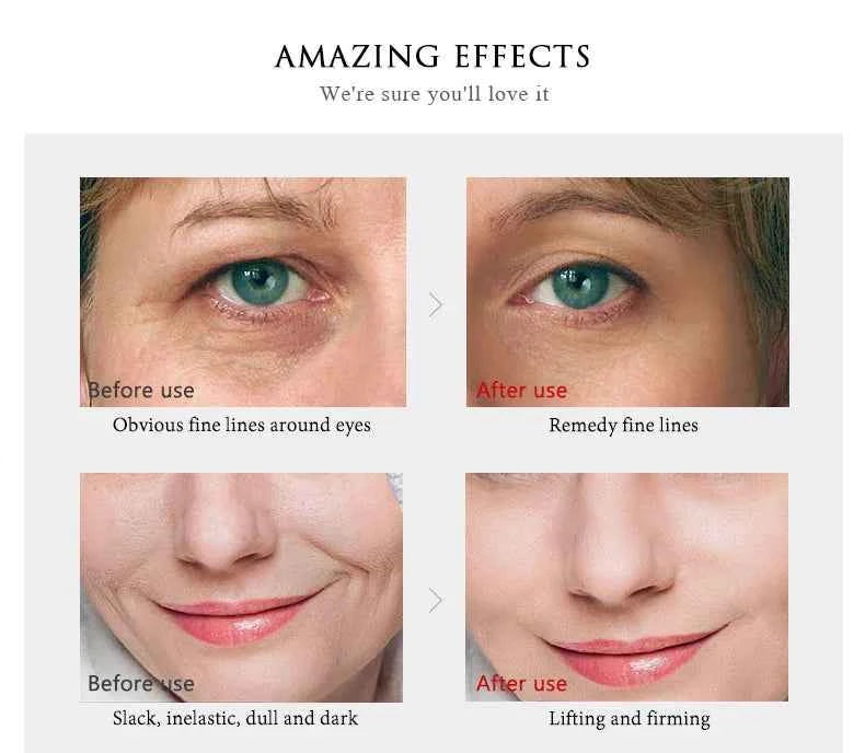 ARTISCARE 24K Gold Serum SET for Facial Care Eye Cream Moisturizing Face Essence Skin Care Products