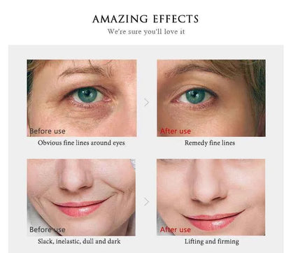 ARTISCARE 24K Gold Serum SET for Facial Care Eye Cream Moisturizing Face Essence Skin Care Products