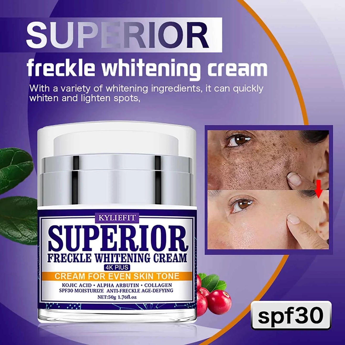 KYLIEFIT Superior Freckle Whitening Cream, Even Skin Tone, With Collagen, Kojic Acid, Spf30, Dark Spots Corrector Face Cream