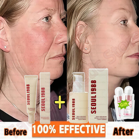 SEOUL 1988 Eye Cream Niacinamide 2% Retinal Acid Ginseng Serum Lighten Fine Lines Firming Pores Brightening Face Korean Skincare - AMULET RING STORE