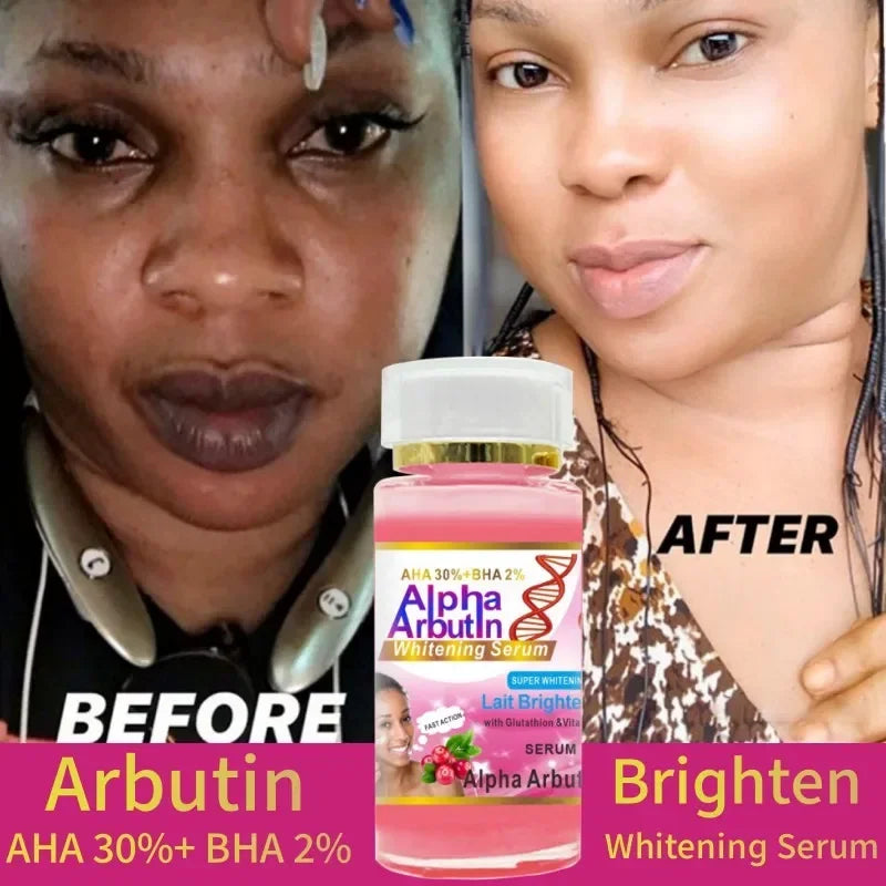 Alpha Arbutin Serum AHA 30%+ BHA 2% Keeps Face Smooth Brightening Moisturizing Improving Dullness Dark Skin Beauty Care Cream - AMULET RING STORE