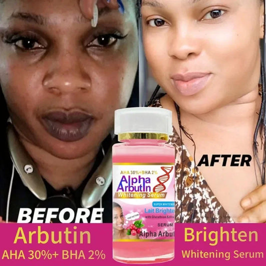Alpha Arbutin Serum AHA 30%+ BHA 2% Keeps Face Smooth Brightening Moisturizing Improving Dullness Dark Skin Beauty Care Cream - AMULET RING STORE