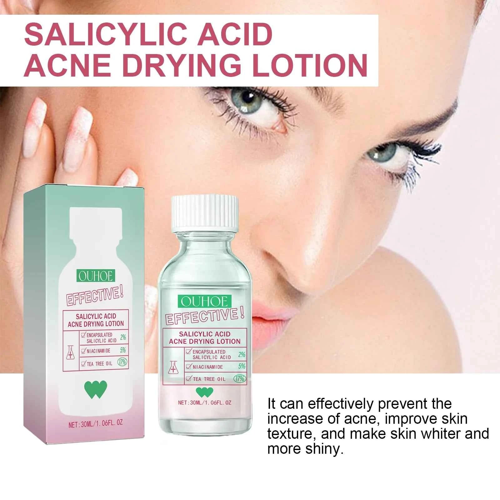 Ouhoe Salicylic Acid Acne Care Lotion Gentle Acne Treatment Pore Shrink Nourishing Improve Skin Texture Glowing Acne Care Lotion
