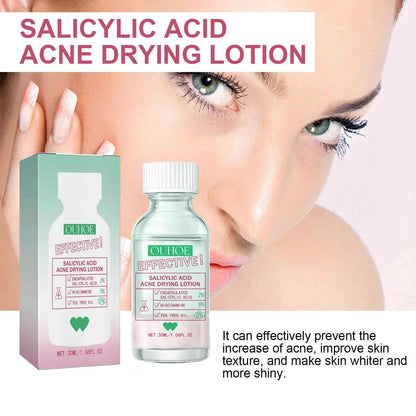 Ouhoe Salicylic Acid Acne Care Lotion Gentle Acne Treatment Pore Shrink Nourishing Improve Skin Texture Glowing Acne Care Lotion