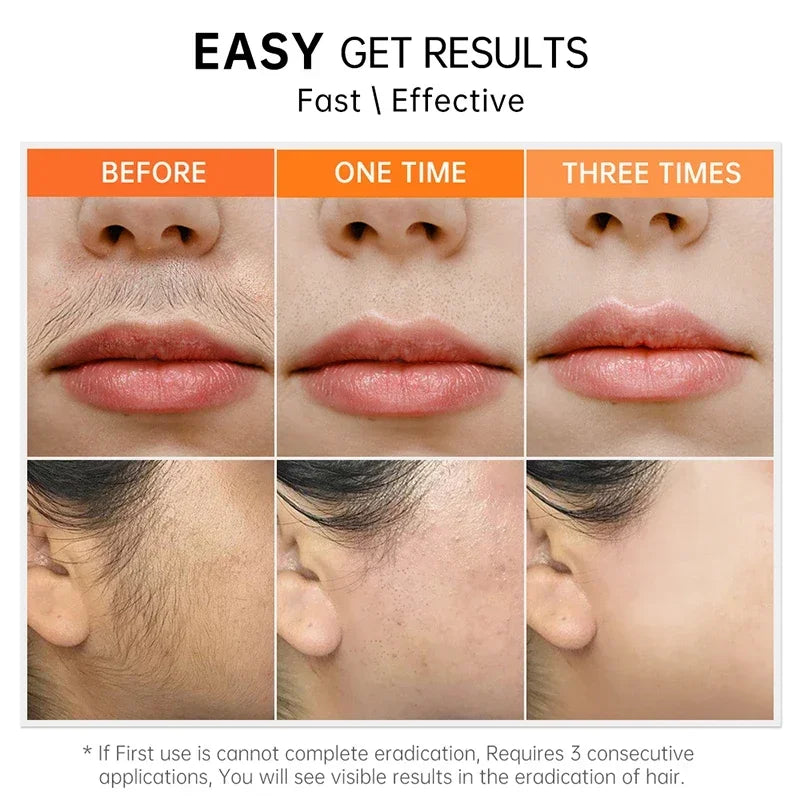 3 Minutes Fast Hair Removal Cream Painless Hair Growth Inhibitor Lip Face Arm Armpit Leg Permanent Depilatory for Men Women Care - AMULET RING STORE
