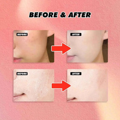 50g Collagen Niacinamide Jelly Cream Deep Moisturizing Pore Shrinking Brightening Niacinamide Gel  Lifting Firming Face Skin Car