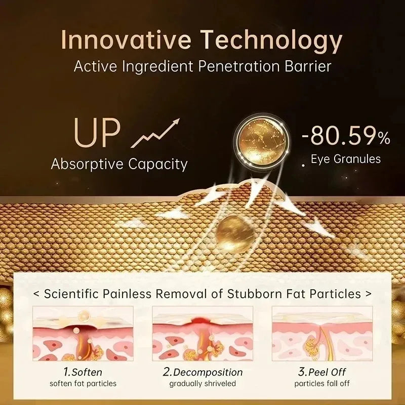 Fat Granules Remover Eye Cream Effective Remove Fat Granules Puffiness Anti-Particles Milia Remover Product Repair Eye Skin Care - AMULET RING STORE