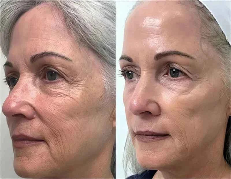 SEOUL 1988 Vitamin C Wrinkle Care 4% Retinol Ginseng Face Serum Firm Fine Lines Eye Cream Hydrating Moisturizing Brightening Set