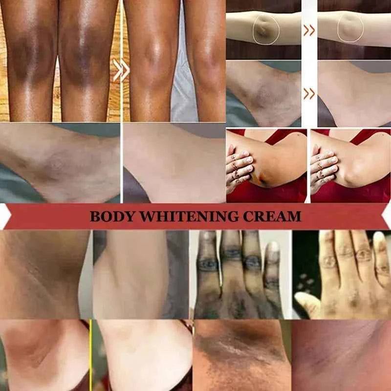 Niacinamide Whitening Cream Stick Remove Dark Spots Bleaching Private Parts Underarm  Brighten Butt Knee Inner Thigh Body Care