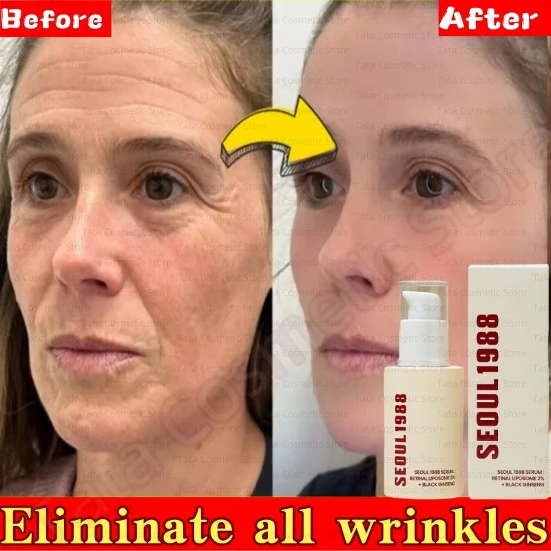 SEOUL 1988 Eye Cream Niacinamide 2% Retinal Acid Ginseng Serum Lighten Fine Lines Firming Pores Brightening Face Korean Skincare - AMULET RING STORE