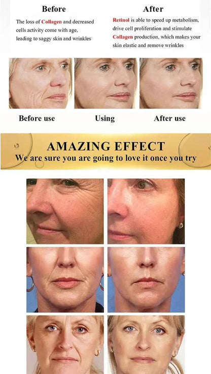 Bee Venom Instant Wrinkle Repair Cream Facial Anti-Aging Rejuvenate Fade Lines Firming Lifting Tightening Moisturizing Skincare