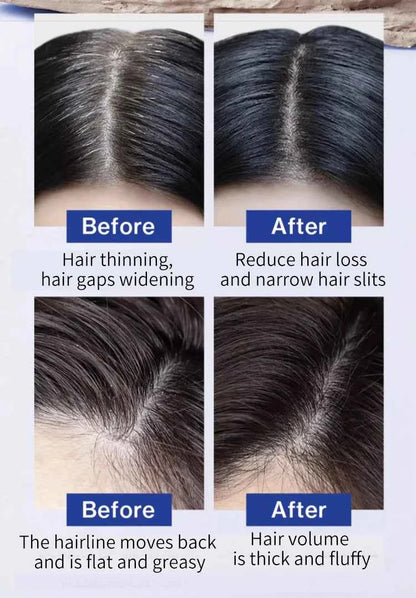 FEG Hair Loss  and Strengthening Hair Care Oil For Men And Women