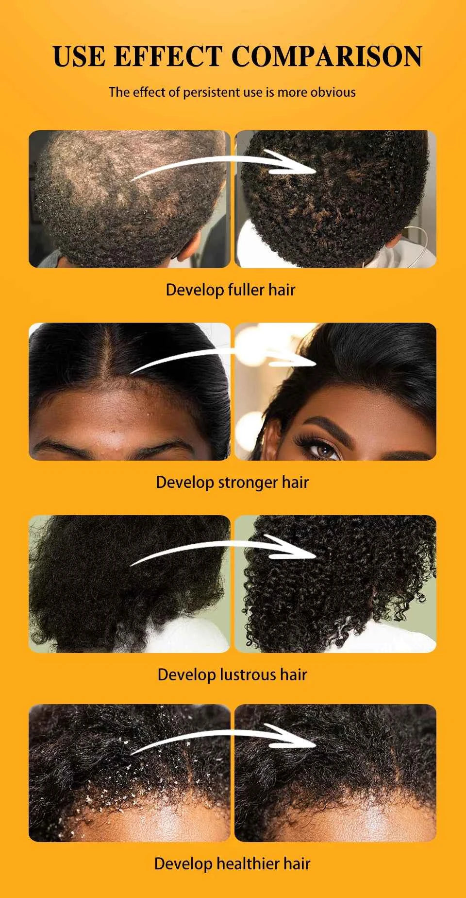 Batana Oil Hair Growth Scalp Strengthening Pure Hair Repair Hair Roots Damaged Hair Care Nourishing For Women Men Anti Hair Loss