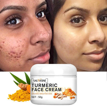 Turmeric lemon Skin Care products Acne Dark Spot Remover Whitening Brighten Facial Serum Face Cream Cleanser Serum Oil Cosmetics