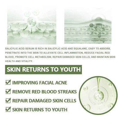 Anti-Acne Face Serum Salicylic Acid Acne Removing Essence Squalane Vitamin E Moisturizing Brightening Korean Skincare Products