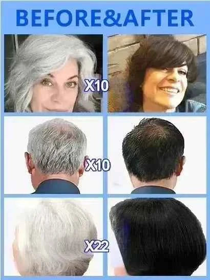White hair killer, remove gray hair and restore natural hair color in 7 days 2025