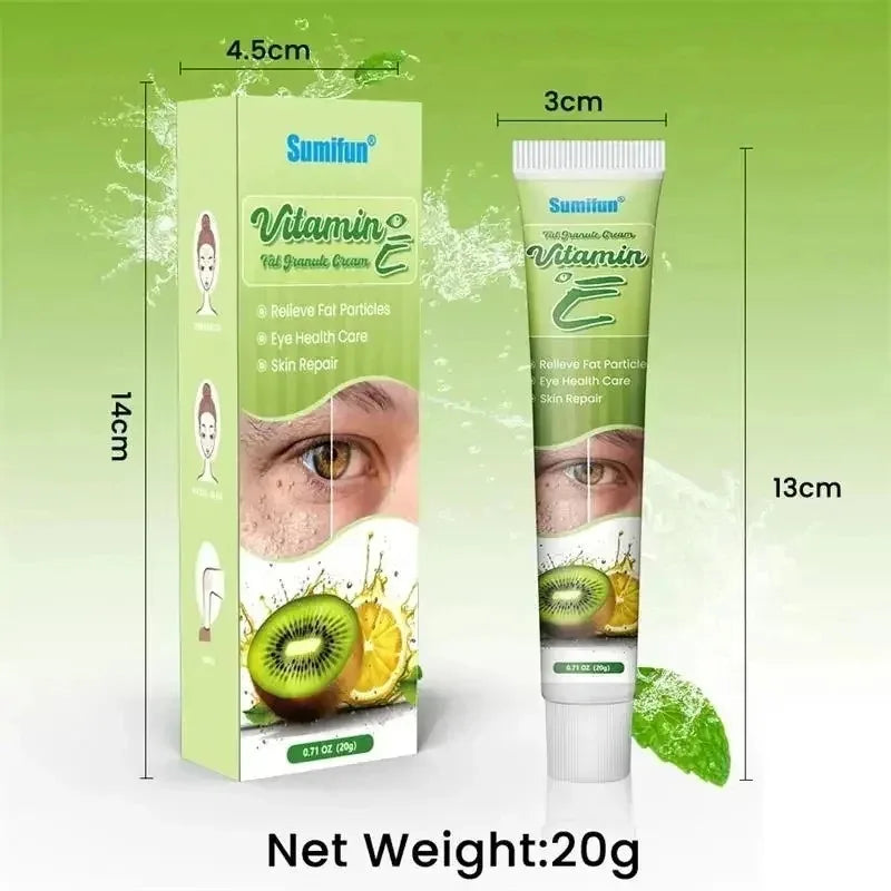 Fat Granules Remover Eye Cream Effective Remove Fat Granules Puffiness Anti-Particles Milia Remover Product Repair Eye Skin Care - AMULET RING STORE