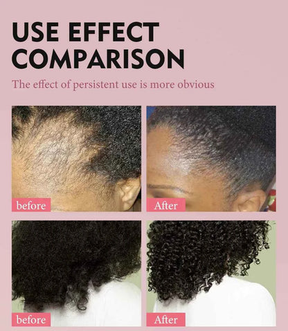 100% Pure Natural KARKAR Butter Hair Growth Oil Anti-Hair Loss Oil Repair Damaged Scalp Treatment Serum Oil For All Hair Types