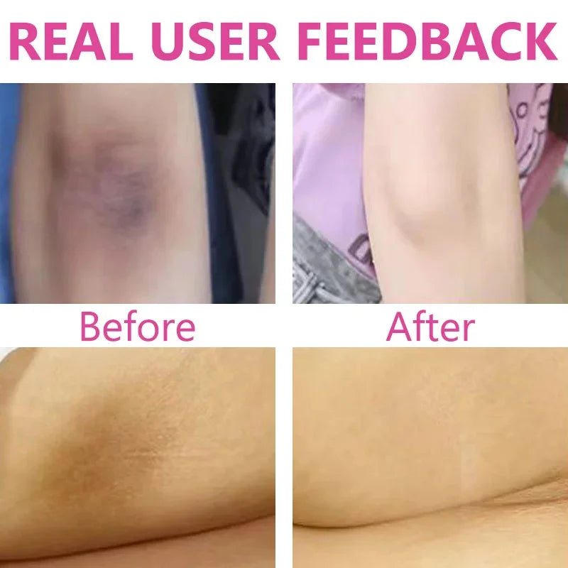 Brightening Cream For Intimate Parts Body Knees Remove Dull Pigments Brighten Serum Elbows Knuckles Lightening Skin Care Product - AMULET RING STORE