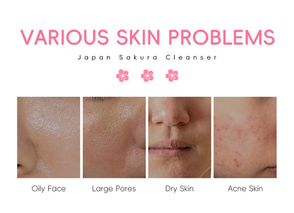 LAIKOU Japan Sakura Cleanser Gentle Deep Cleaning Oil Control Moisturizing Shrink Pores Face Skin Care Skin Cleanser 50g
