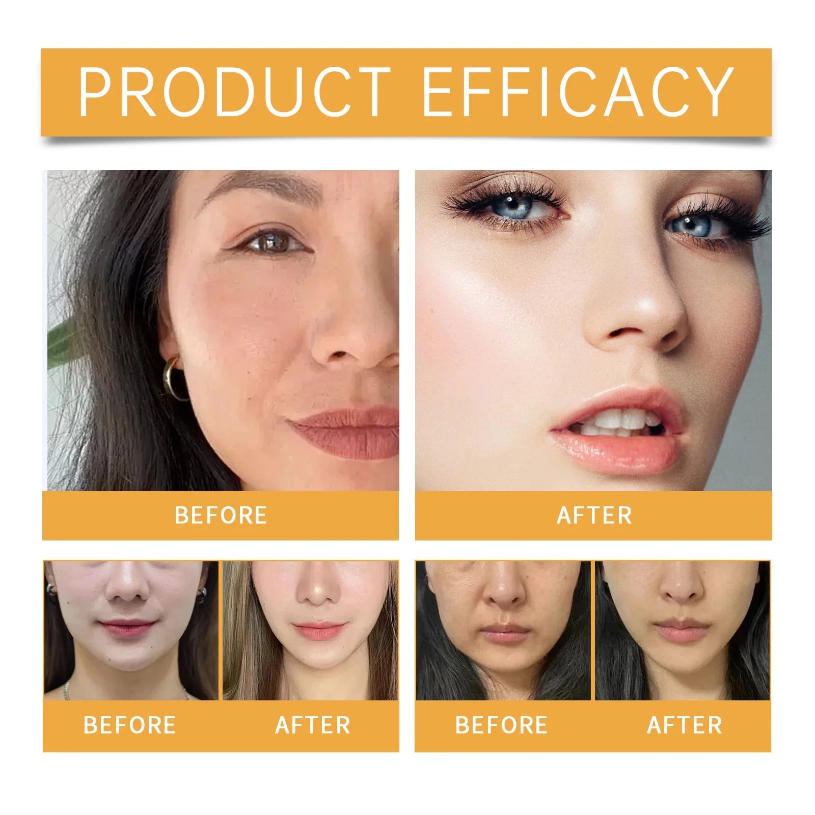 Nasolabial Folds Patch Contain Collagen Hyaluronic Acid Firming Skin Fade Fine Lines Deep Moisturizing Facial Mask Anti Wrinkle