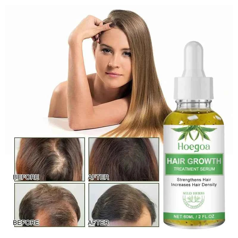 Fast Hair Growth Oil Africa Crazy Traction Alopecia Serum Anti Hair Break Thicken Hair Loss Treatment Spray For Man Women 60ML