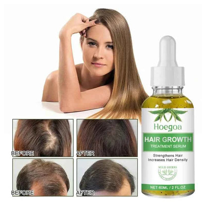 Fast Hair Growth Oil Africa Crazy Traction Alopecia Serum Anti Hair Break Thicken Hair Loss Treatment Spray For Man Women 60ML