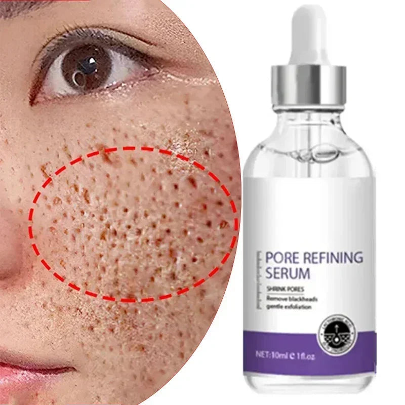 Skin Texture | Pore Refining Resurfacing, Brightening Facial Serum with Retinol and Niacinamide Non-Comedogenic - AMULET RING STORE
