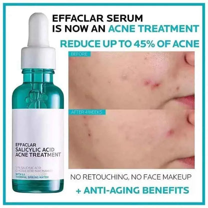 High Quality Face Serum Combo Hydrating, Brightening, Anti-Acne, Anti-Aging, Pore Care Bulk Supply