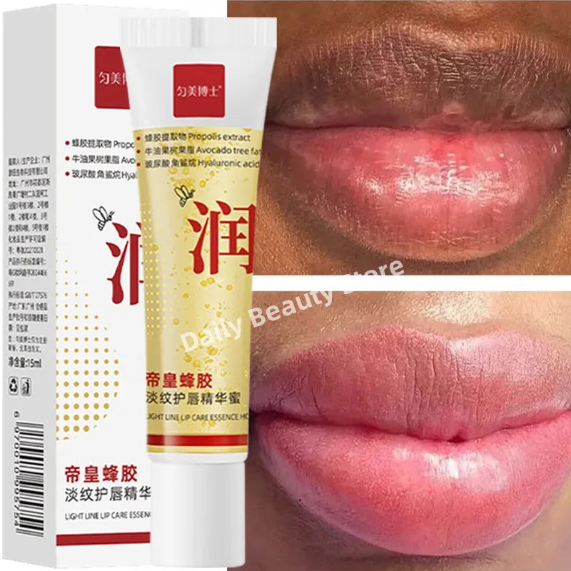 Remove Dark Lip Balm Fast Lightening Pink Lip Exfoliating Fade Lip Line Dead Skin Moisturizer Korean Care Products Beauty Health - AMULET RING STORE