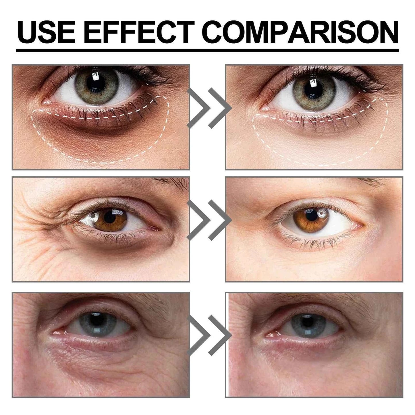 Niacinamide Eye Cream Reduces Dark Circles and Eye Bags Sodium Hyaluronate Moisturizing Essence Reduces Puffiness Eye Care